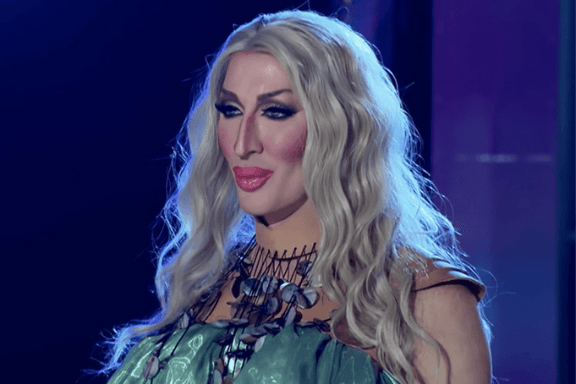 Do's and Don'ts of Lip Filler